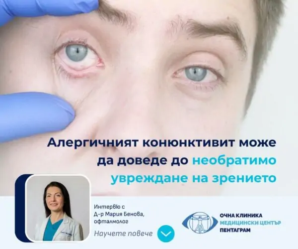 конюнктивит